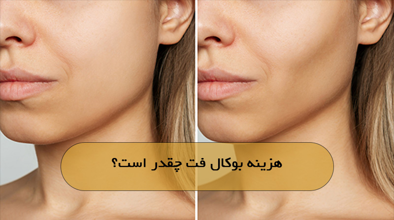 هزینه بوکال فت چقدر است؟