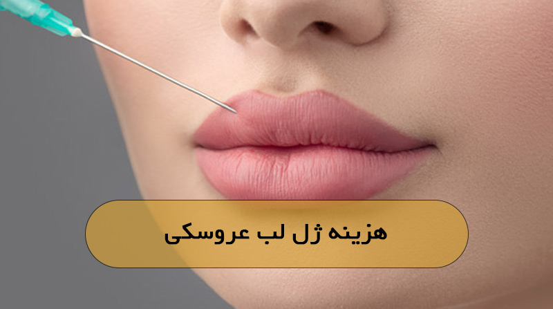 هزینه ژل لب عروسکی