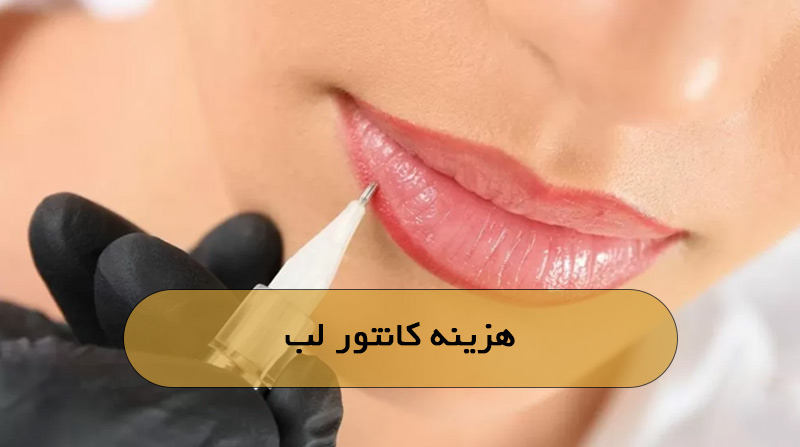 هزینه کانتور لب