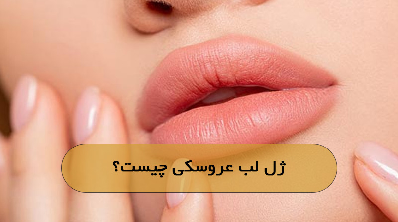 ژل لب عروسکی چیست؟