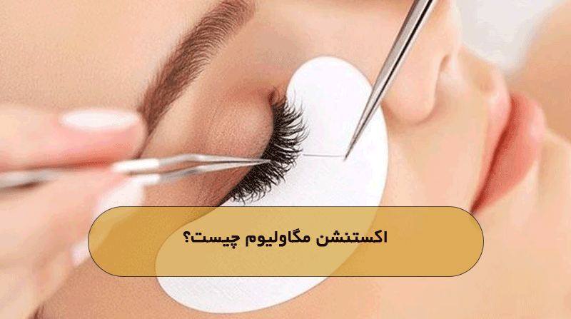 اکستنشن مگاولیوم چیست؟