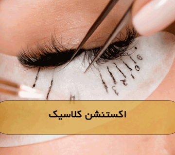 اکستنشن کلاسیک