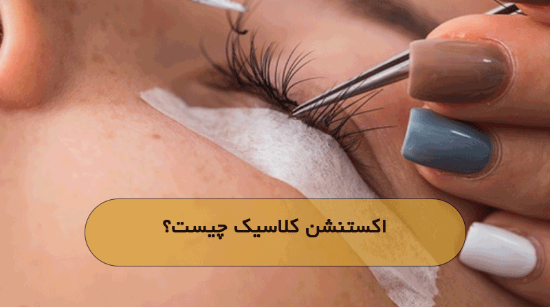 اکستنشن کلاسیک چیست؟