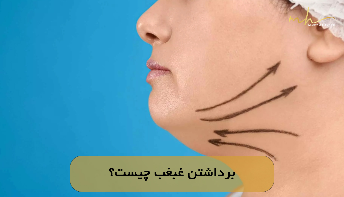 برداشتن غبغب چیست؟