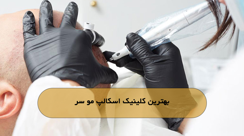 بهترین کلینیک اسکالپ مو سر