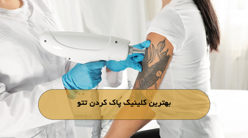 بهترین کلینیک پاک کردن تتو