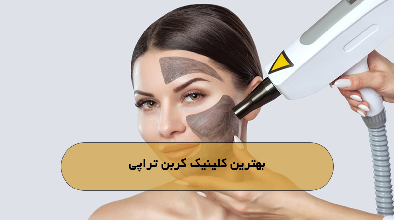 بهترین کلینیک کربن تراپی