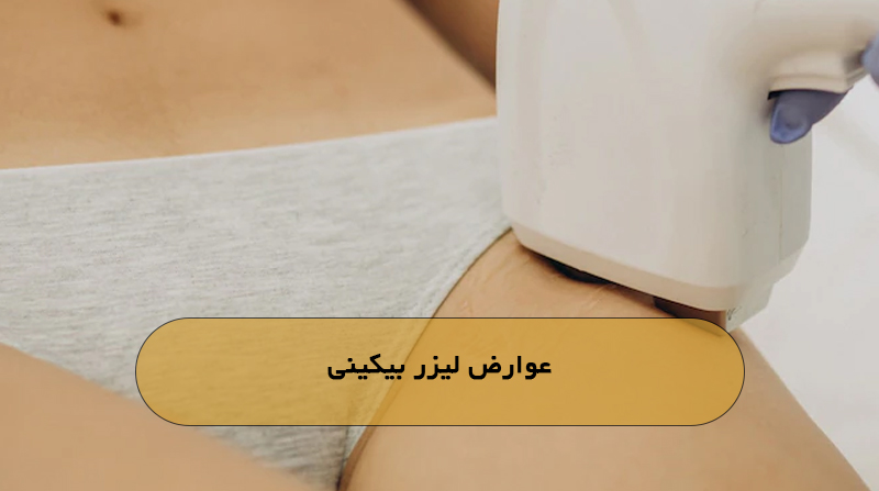 عوارض لیزر بیکینی