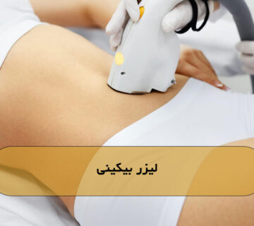 لیزر بیکینی
