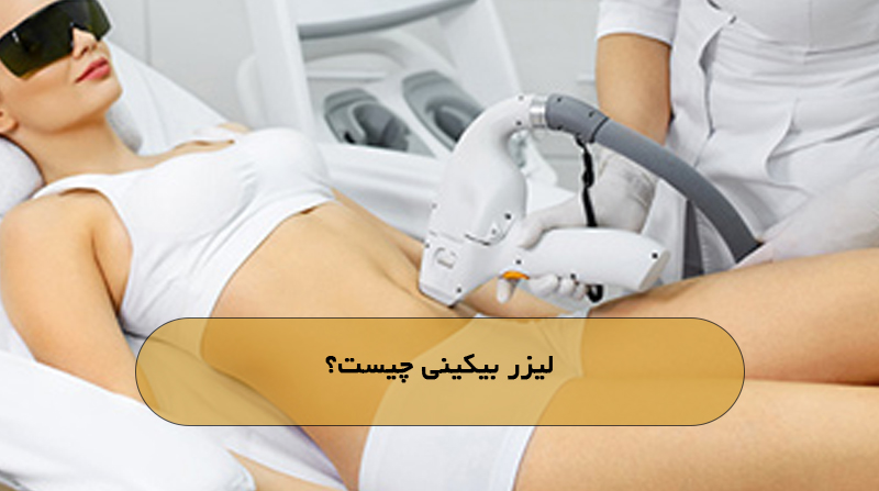 لیزر بیکینی چیست؟