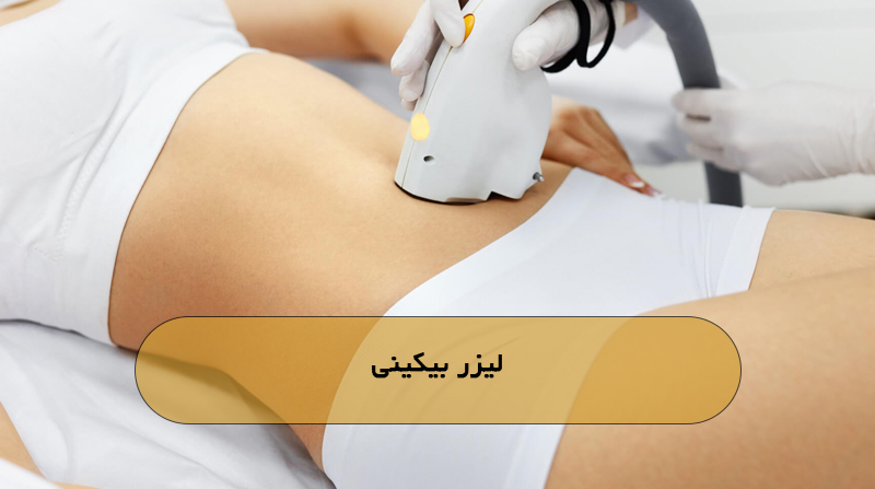 لیزر بیکینی