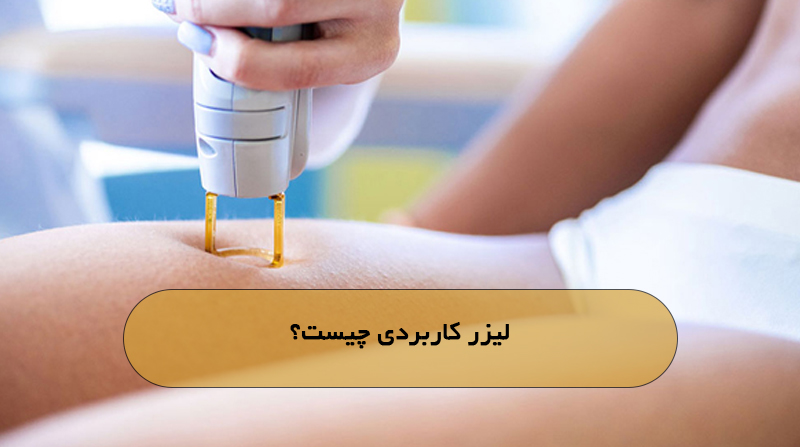 لیزر کاربردی چیست؟