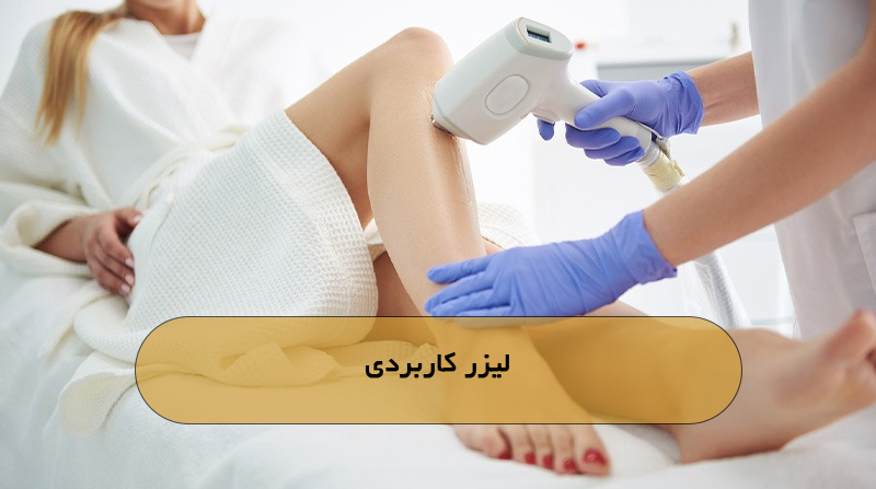 لیزر کاربردی