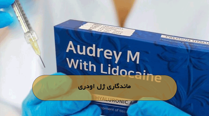 ماندگاری ژل اودری