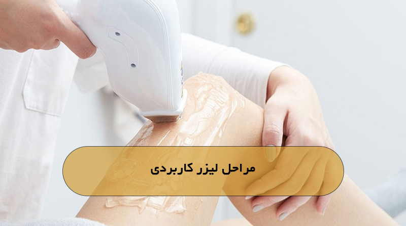 مراحل لیزر کاربردی
