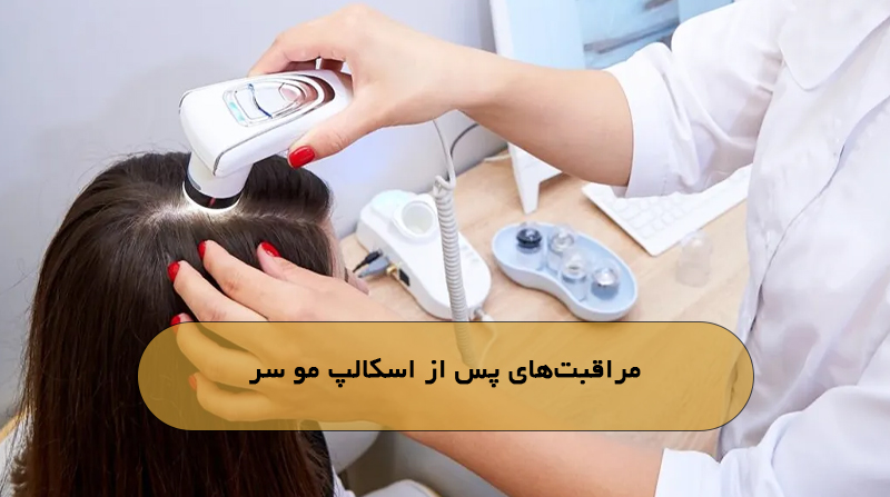 مراقبت‌های پس از اسکالپ مو سر