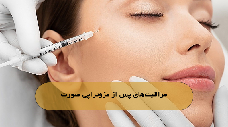 مراقبت‌های پس از مزوتراپی صورت