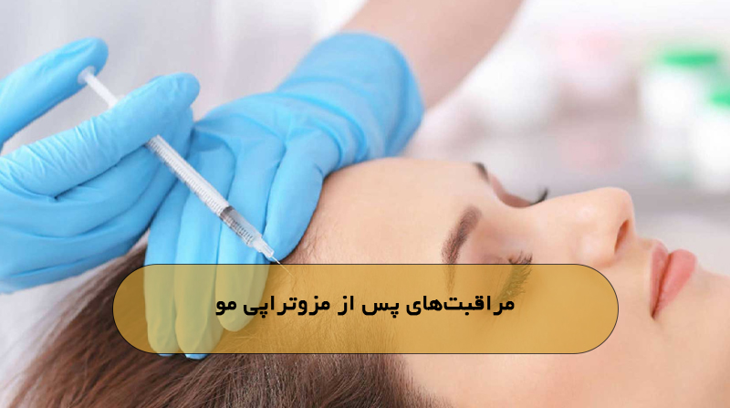 مراقبت‌های پس از مزوتراپی مو