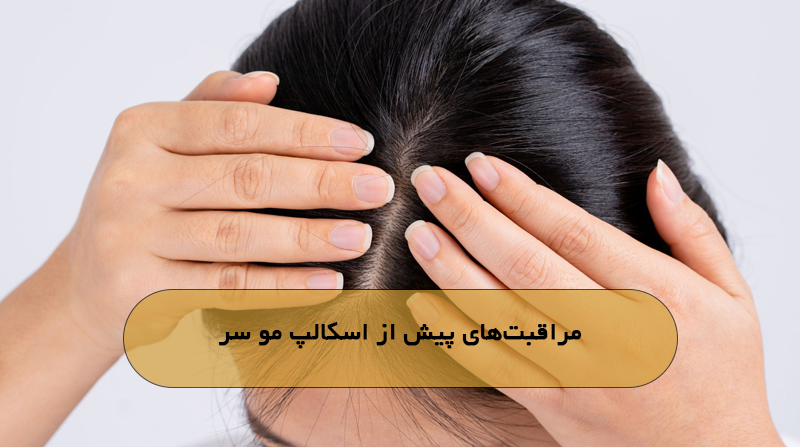 مراقبت‌های پیش از اسکالپ مو سر