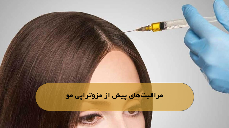 مراقبت‌های پیش از مزوتراپی مو