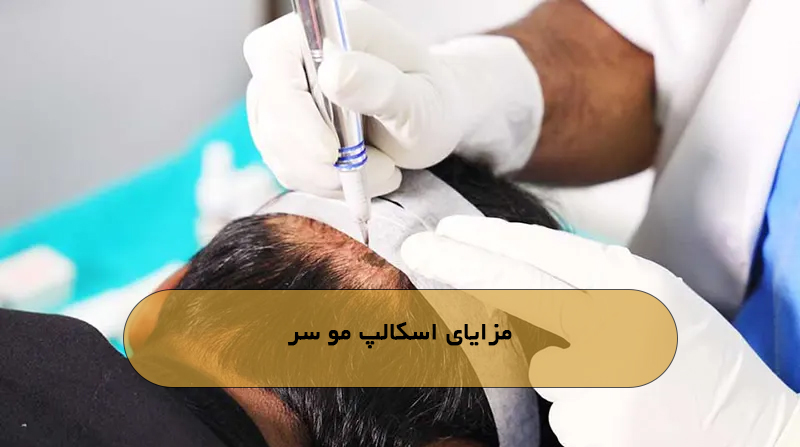 مزایای اسکالپ مو سر