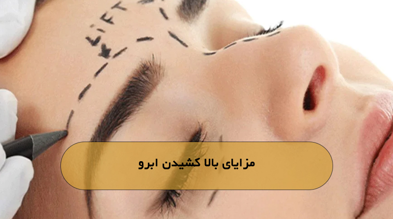 مزایای بالا کشیدن ابرو