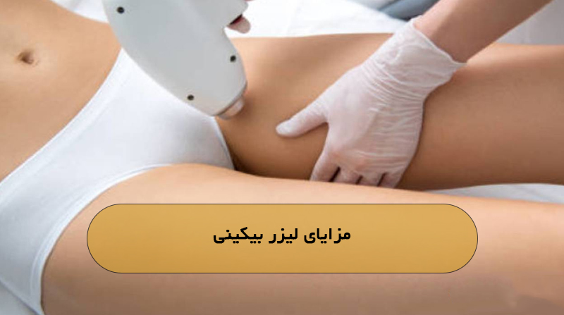 مزایای لیزر بیکینی