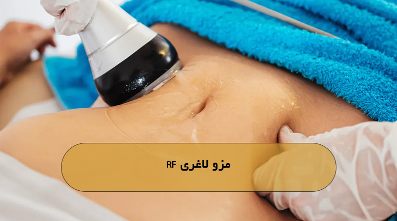مزو لاغری RF