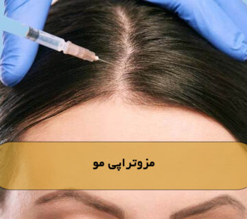 مزوتراپی مو