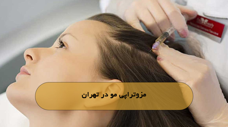 مزوتراپی مو در تهران