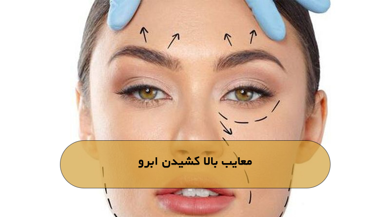 معایب بالا کشیدن ابرو