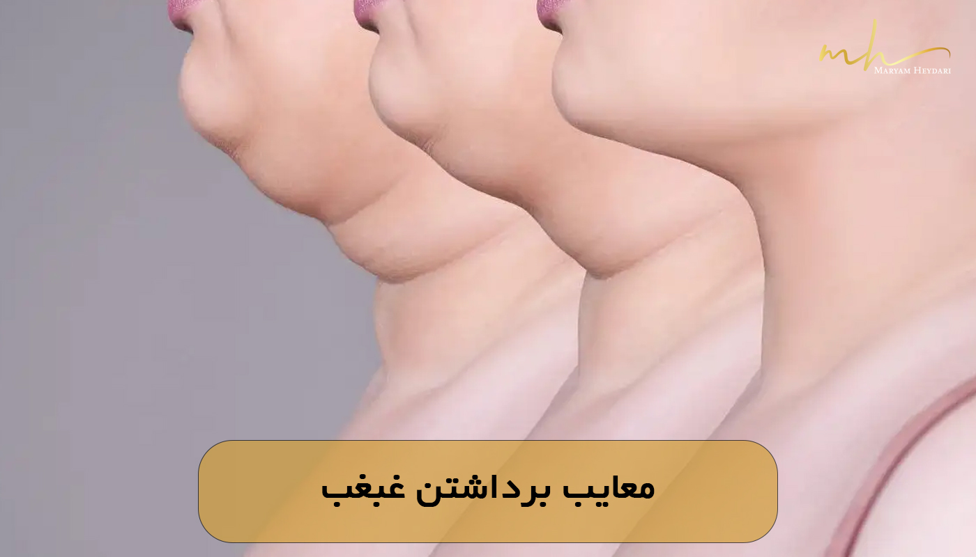 معایب برداشتن غبغب