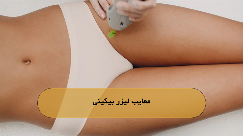معایب لیزر بیکینی