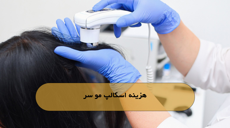 هزینه اسکالپ مو سر