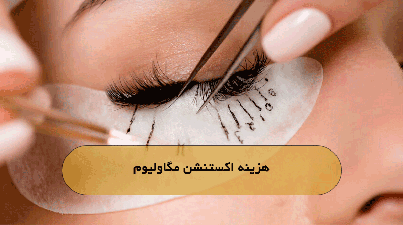 هزینه اکستنشن مگاولیوم