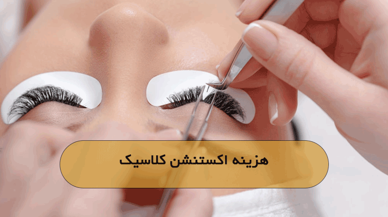 هزینه اکستنشن کلاسیک