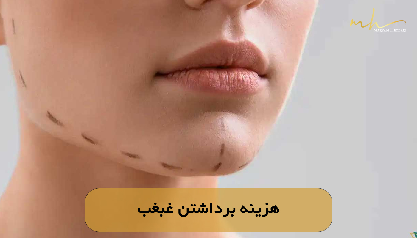 هزینه برداشتن غبغب