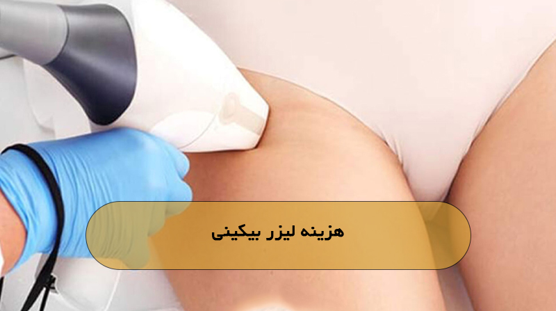 هزینه لیزر بیکینی