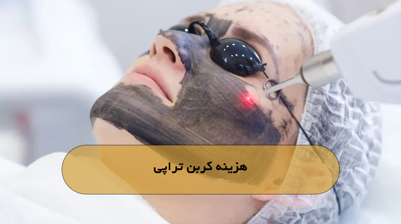 هزینه کربن تراپی