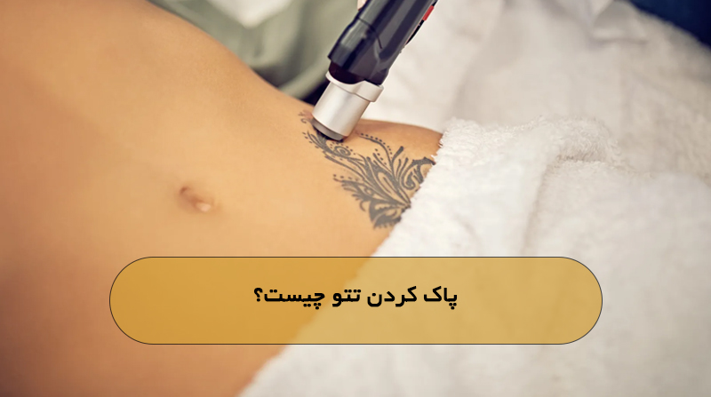 پاک کردن تتو چیست؟