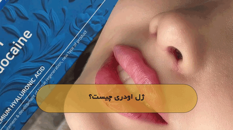 ژل اودری چیست؟