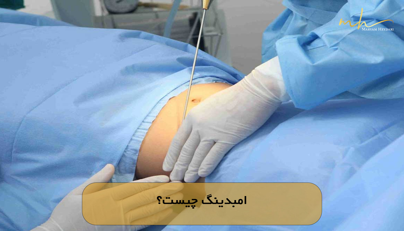 امبدینگ چیست؟