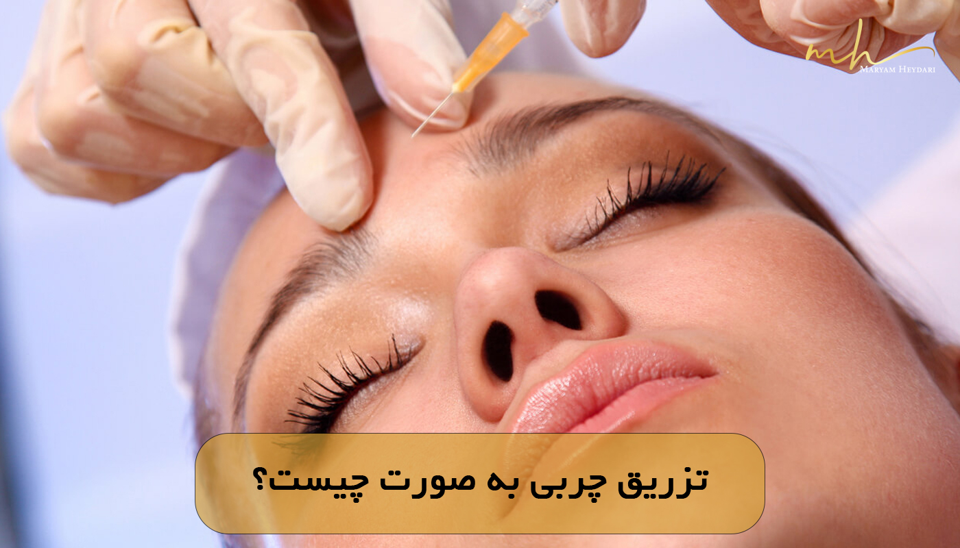 تزریق چربی به صورت چیست؟