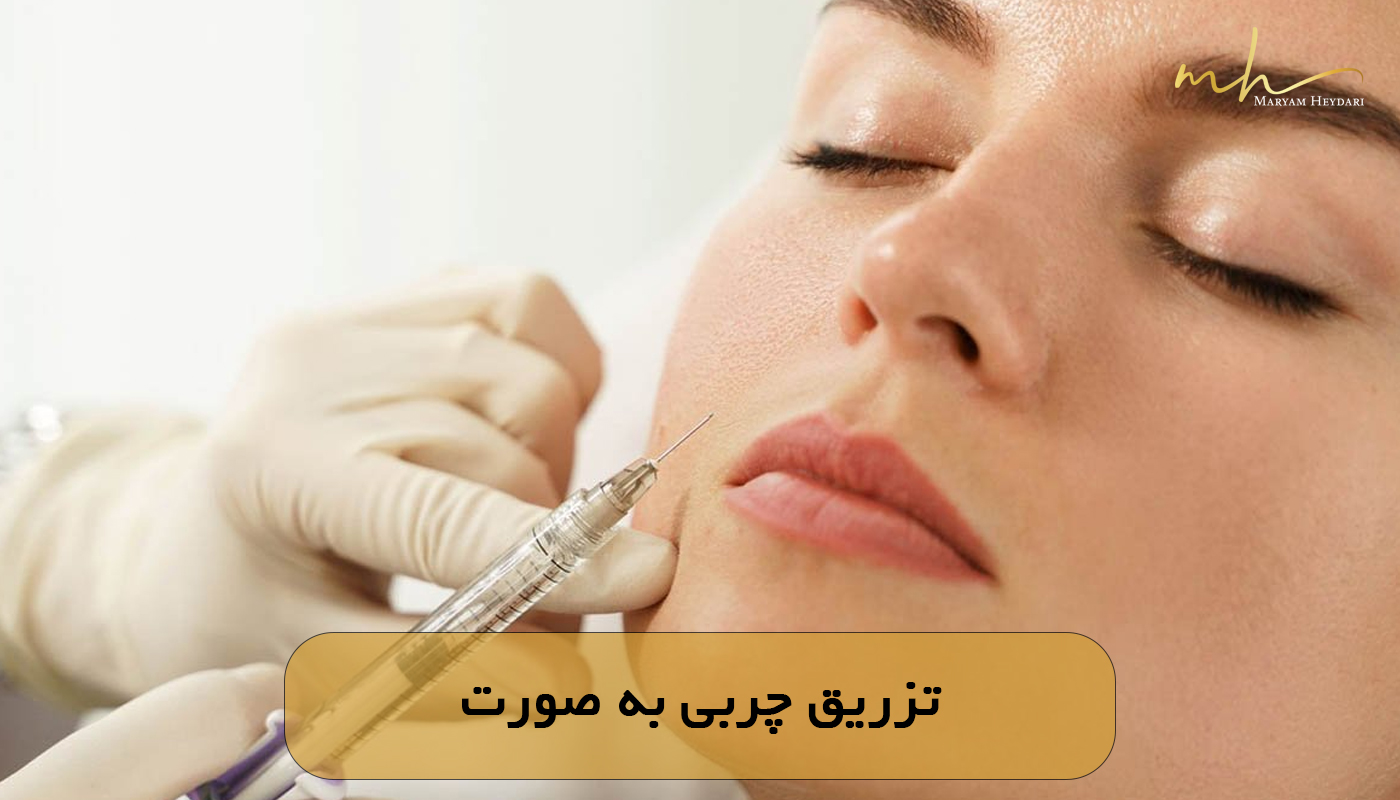 تزریق چربی به صورت