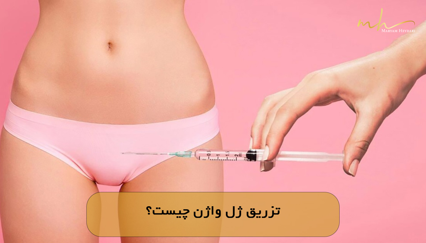 تزریق ژل واژن چیست؟