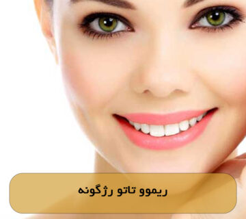 ریموو تاتو رژگونه