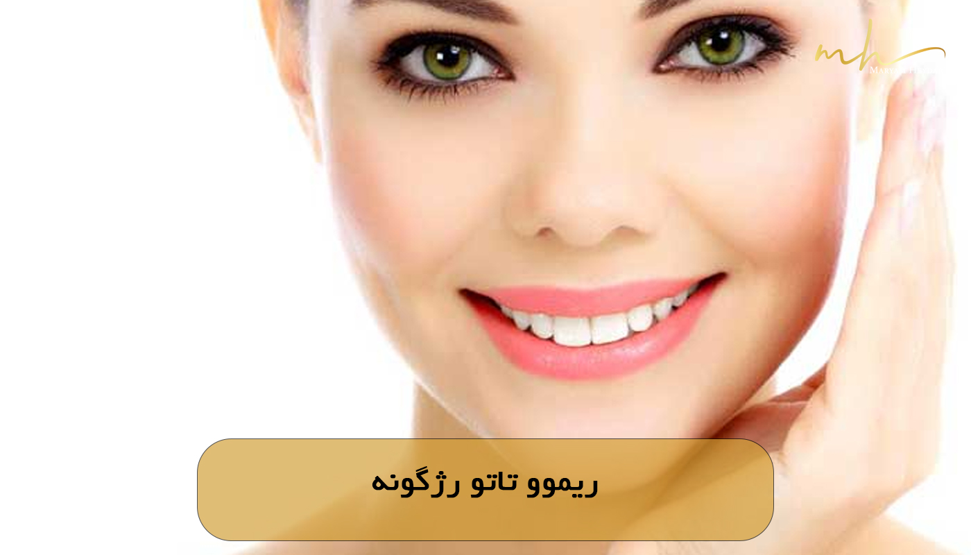 ریموو تاتو رژگونه