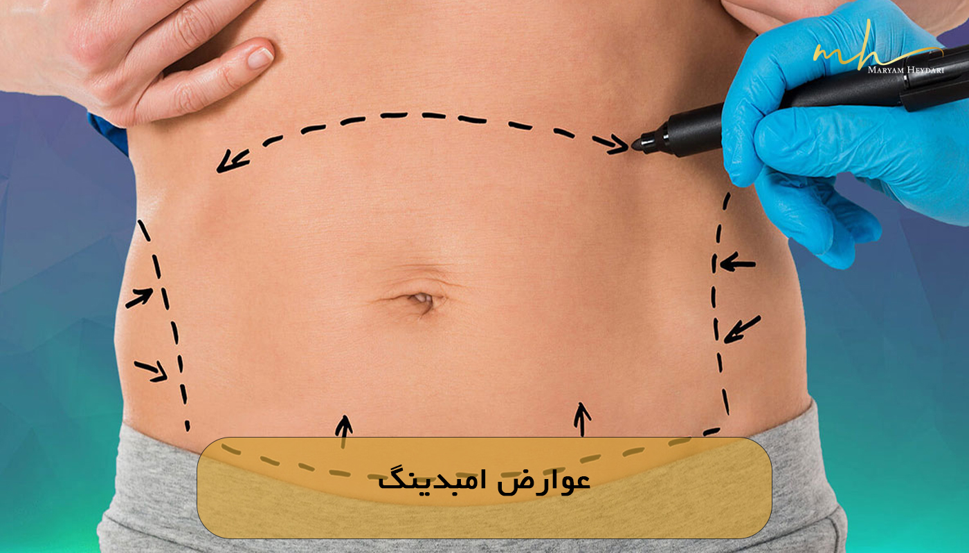 عوارض امبدینگ