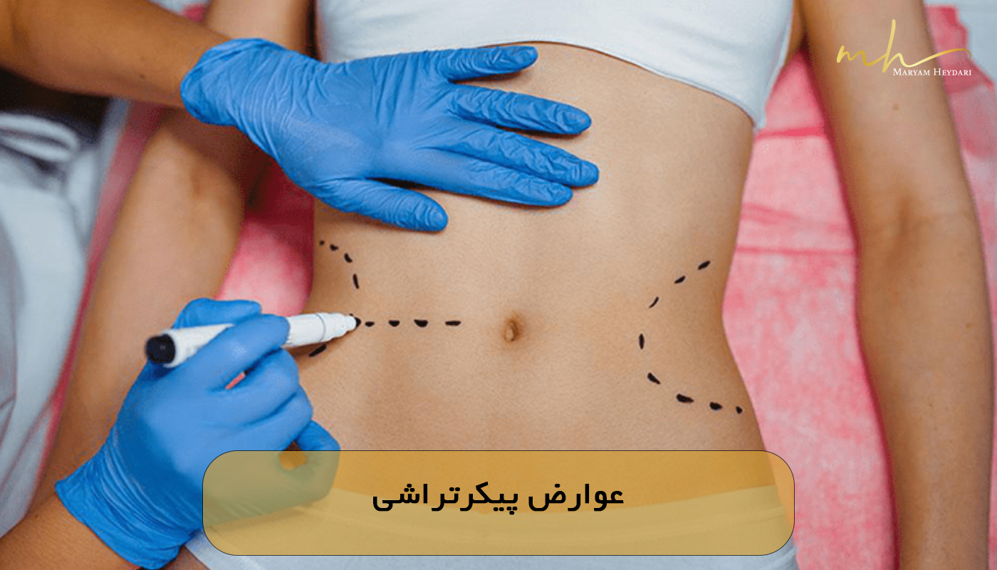 عوارض پیکرتراشی