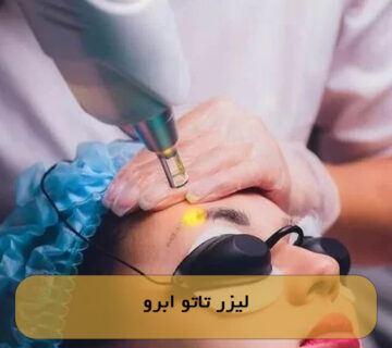 لیزر تاتو ابرو